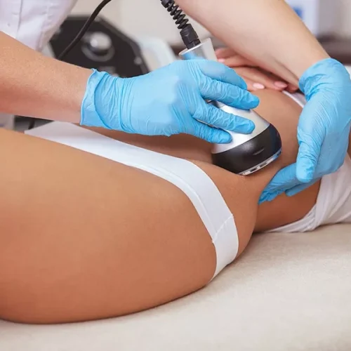 lipocavitaçãojardimdanfer